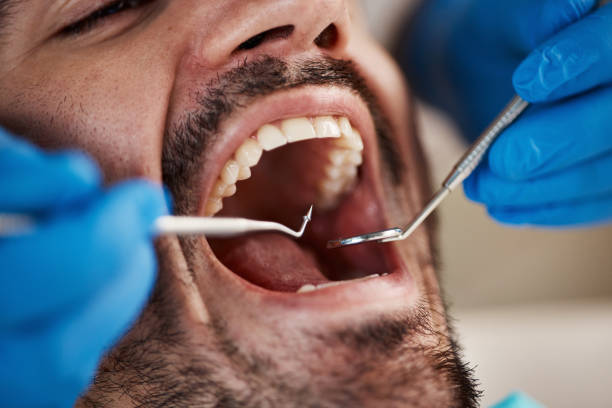 Best Weekend Emergency Dentist in Halsey, OR