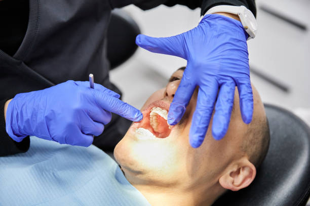 Best Emergency Wisdom Teeth Removal in Halsey, OR